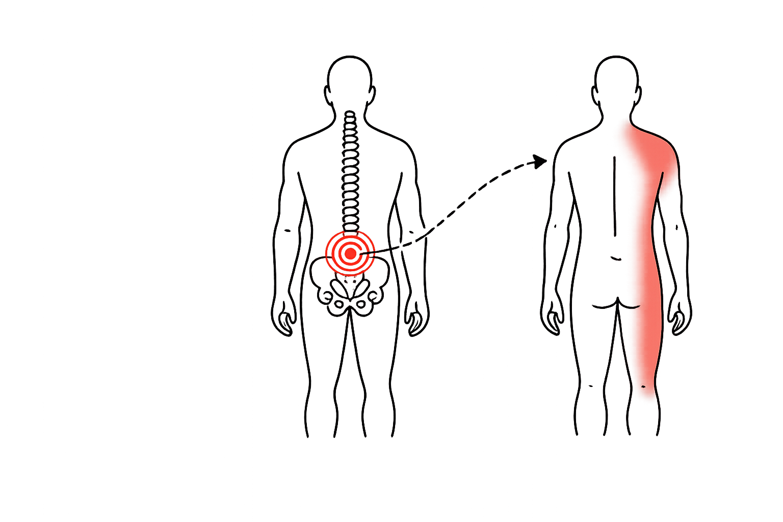 Illustration showing how low back pain can be influenced by nearby movement patterns.